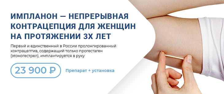 Установка контрацептива Импланон® = 23900 рублей
